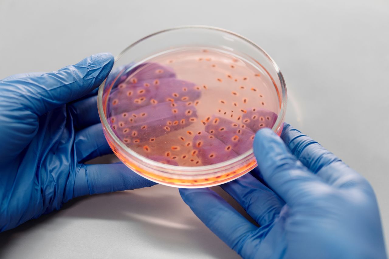 ours-journey Close-up of gloved hands holding a petri dish with bacterial culture in a lab setting.