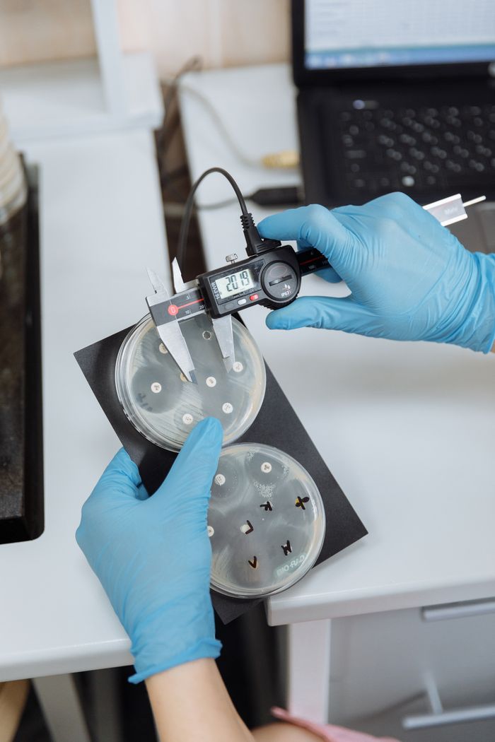 gallery-4 Scientist measures bacteria growth in Petri dishes using digital calipers.